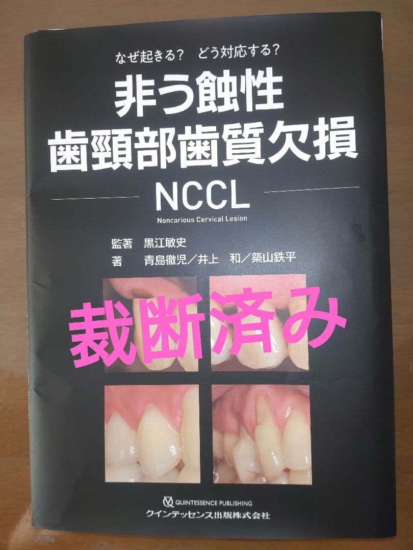 【裁断済み】非う蝕性歯頸部歯質欠損ＮＣＣＬ